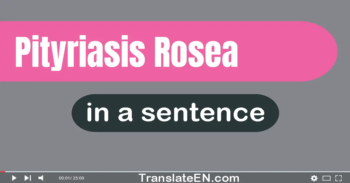 Pityriasis Rosea in a sentence