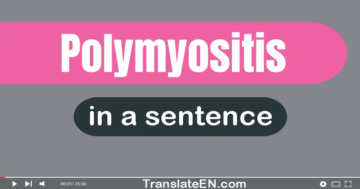 Use "polymyositis" in a sentence | "polymyositis" sentence examples