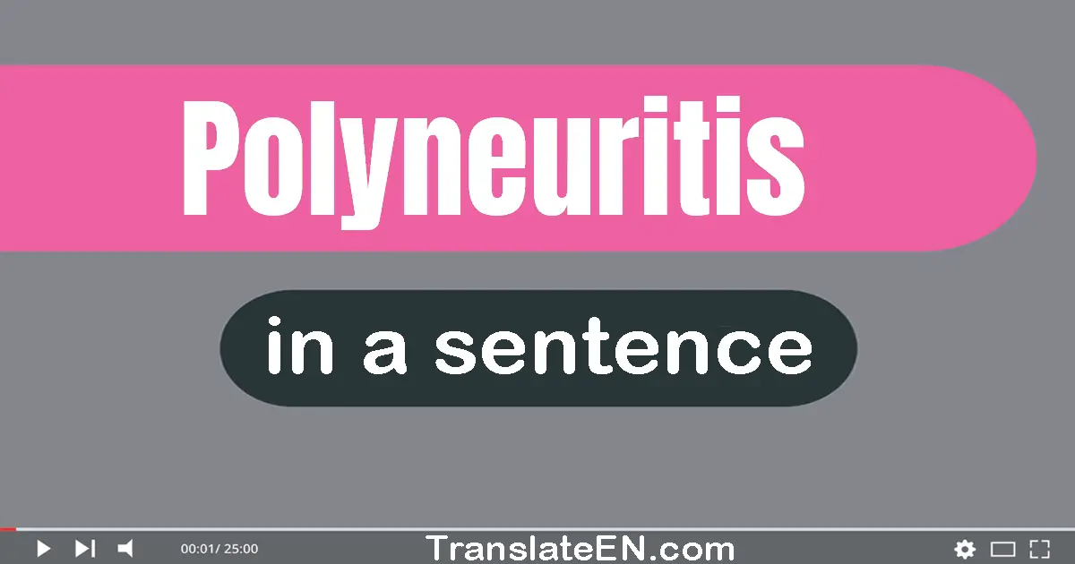Use "polyneuritis" in a sentence | "polyneuritis" sentence examples