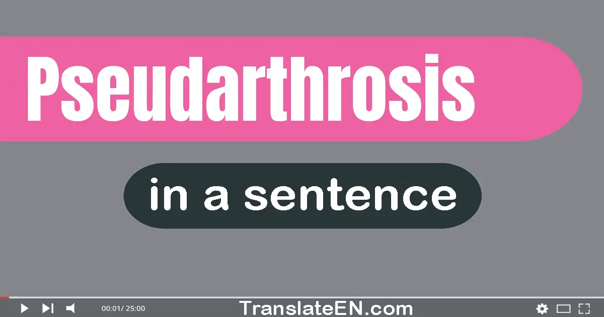 Pseudarthrosis in a sentence