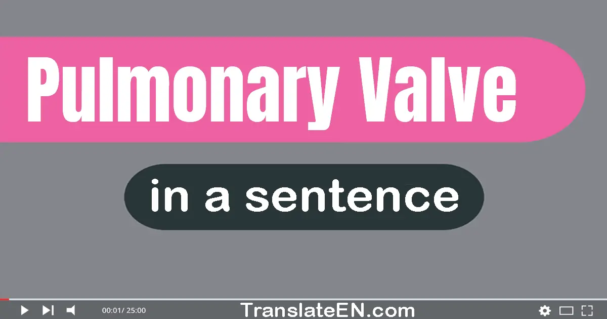 Pulmonary Valve in a sentence