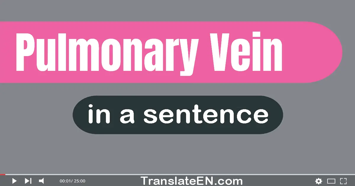 Pulmonary Vein in a sentence