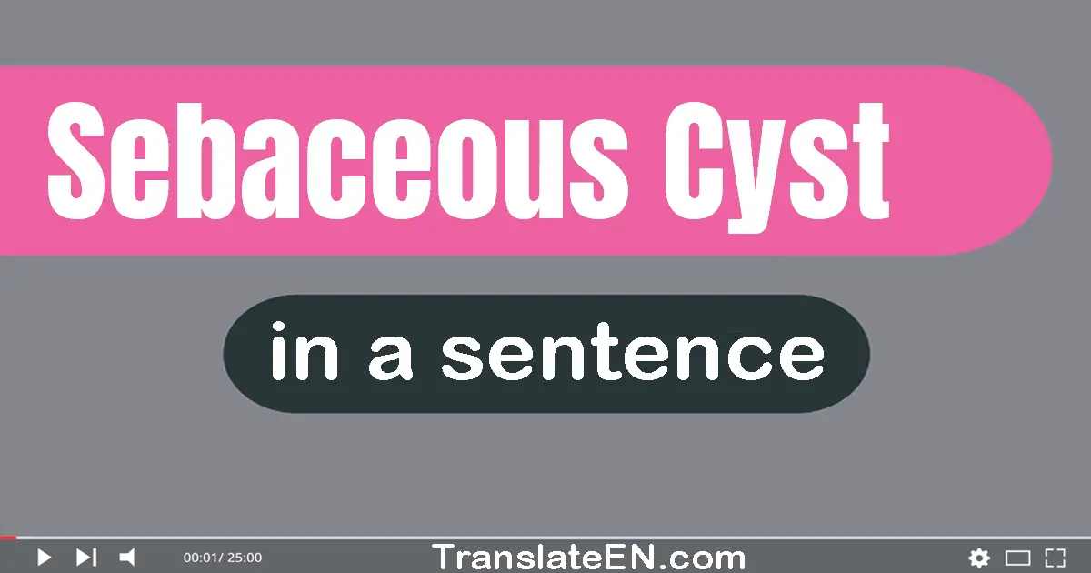 Sebaceous Cyst in a sentence