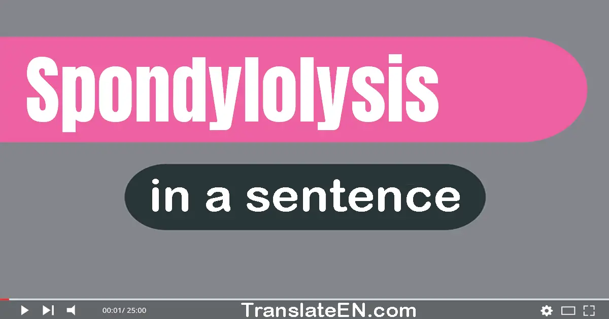 Spondylolysis in a sentence