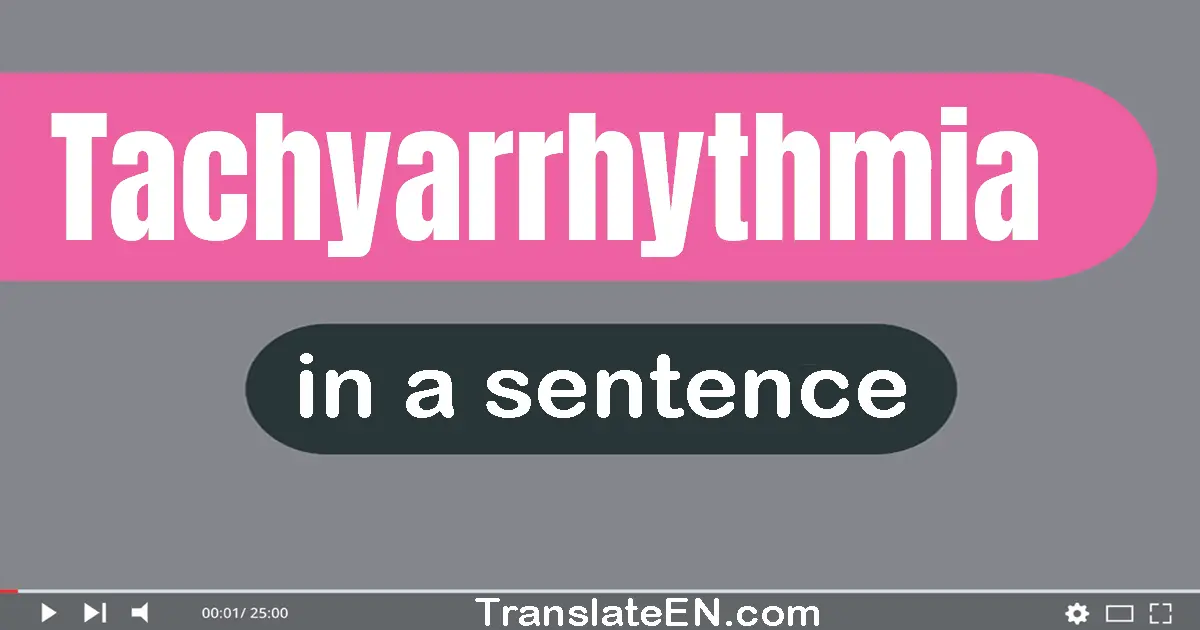 Tachyarrhythmia in a sentence