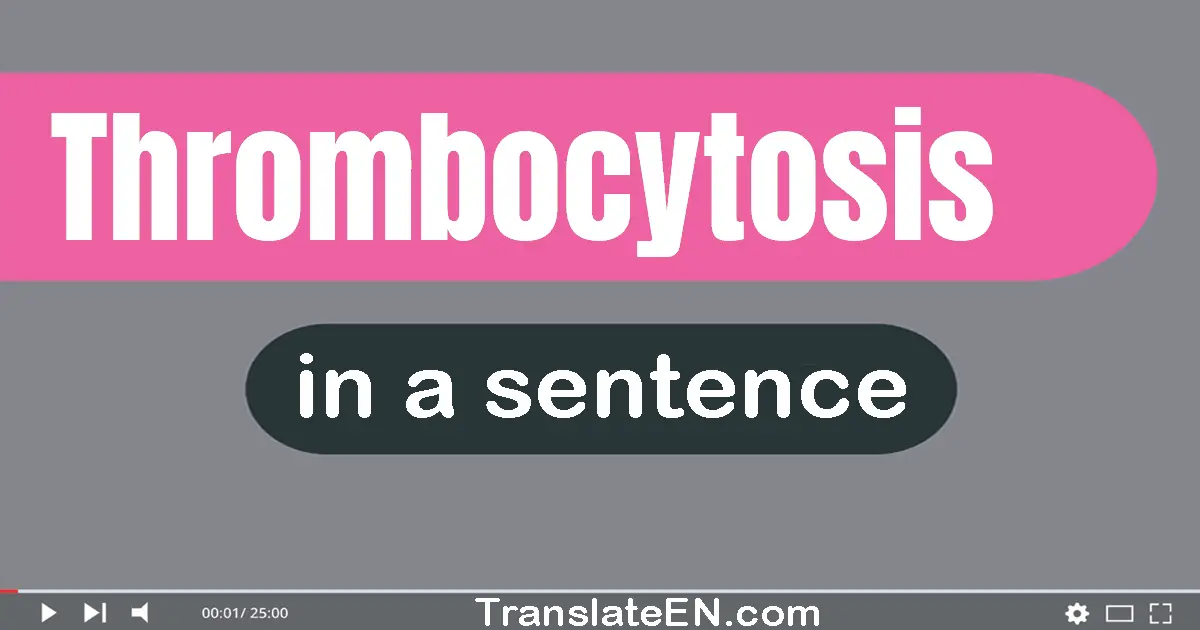 Thrombocytosis in a sentence