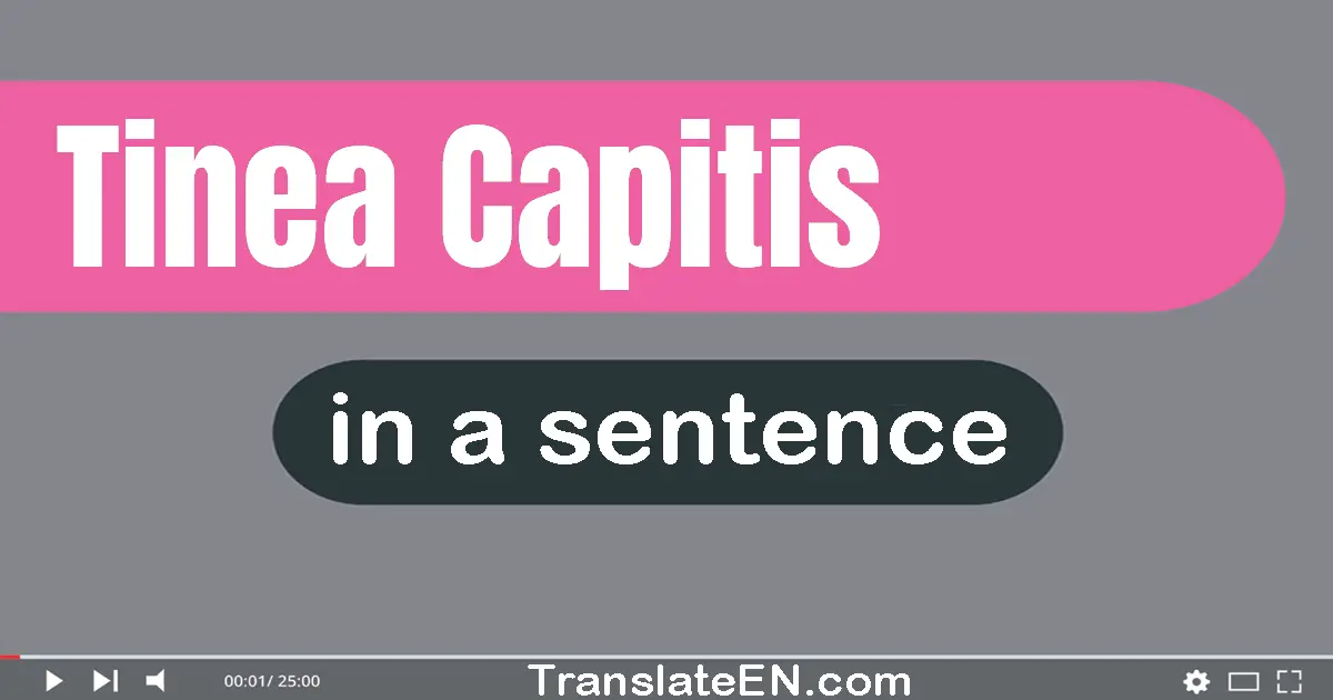 Tinea Capitis in a sentence