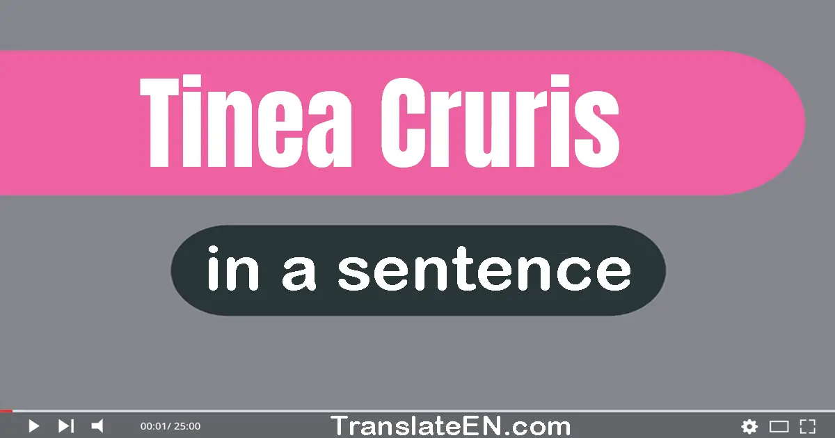 Tinea Cruris in a sentence