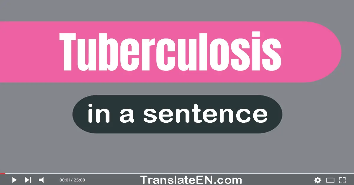 Use "tuberculosis" in a sentence | "tuberculosis" sentence examples