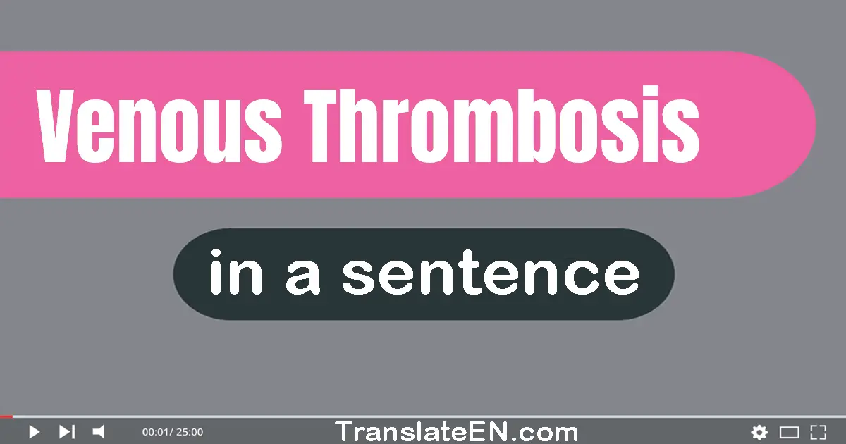 Venous Thrombosis in a sentence